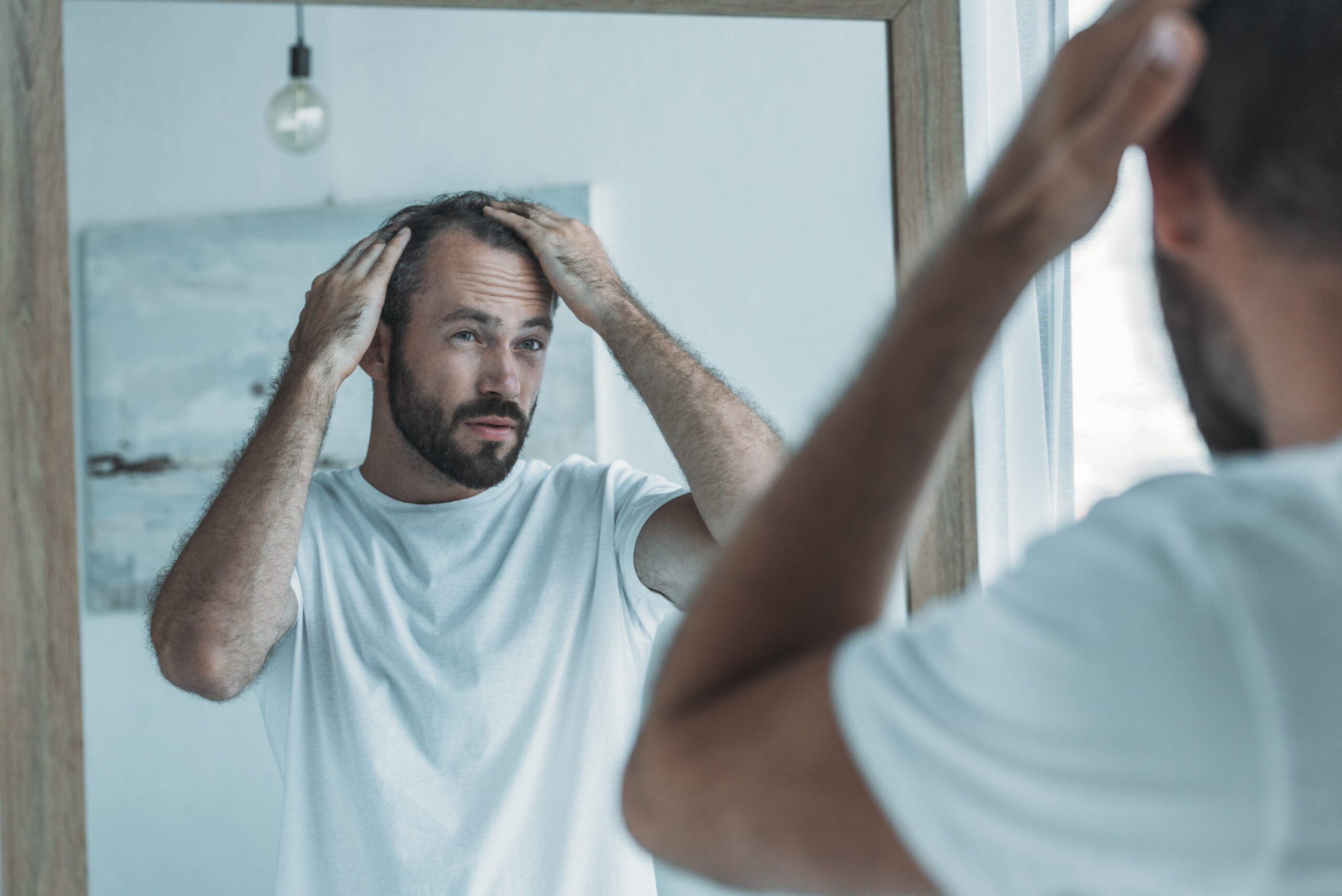 Hair Loss Men